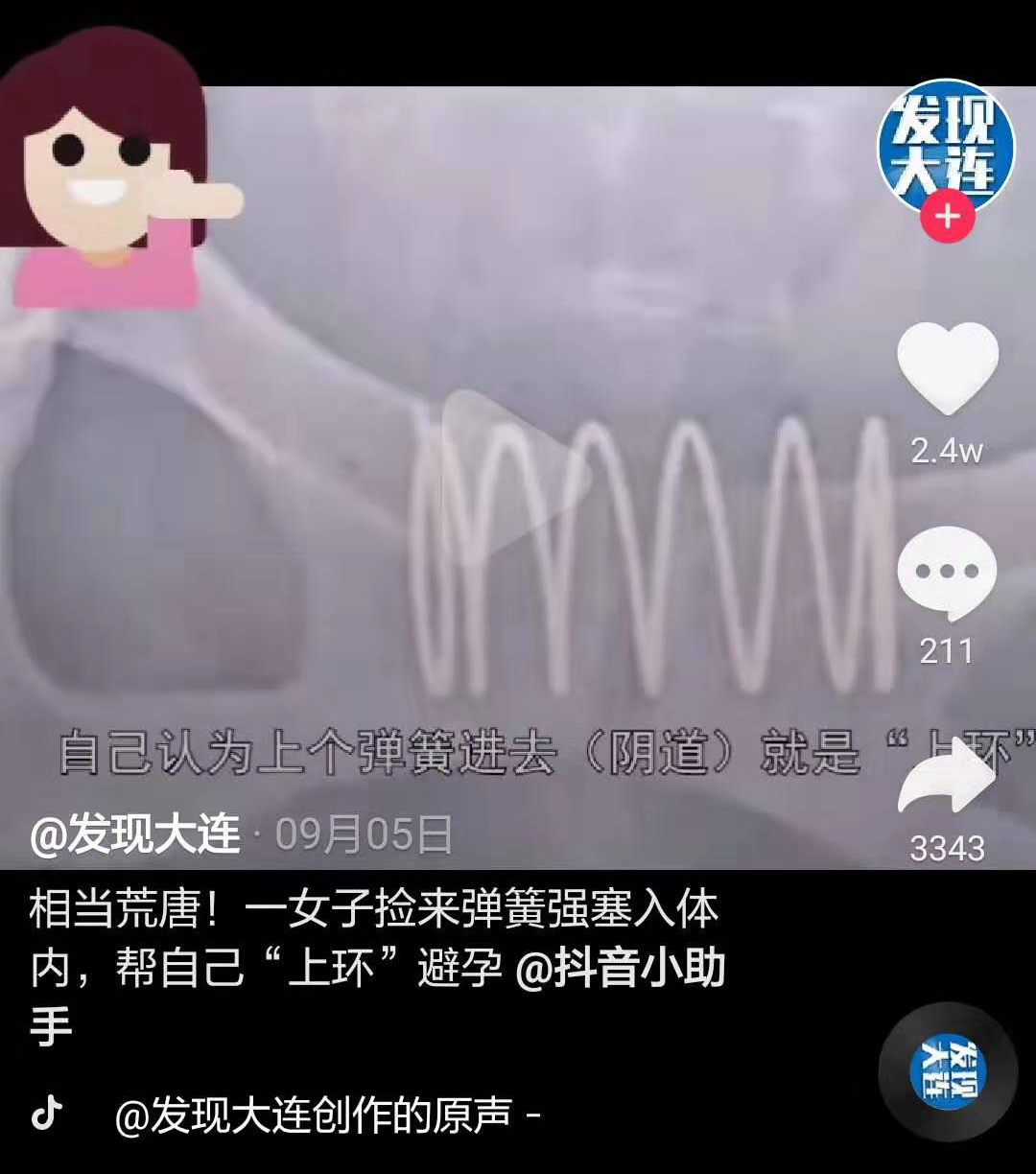 一女子把弹簧当节育环